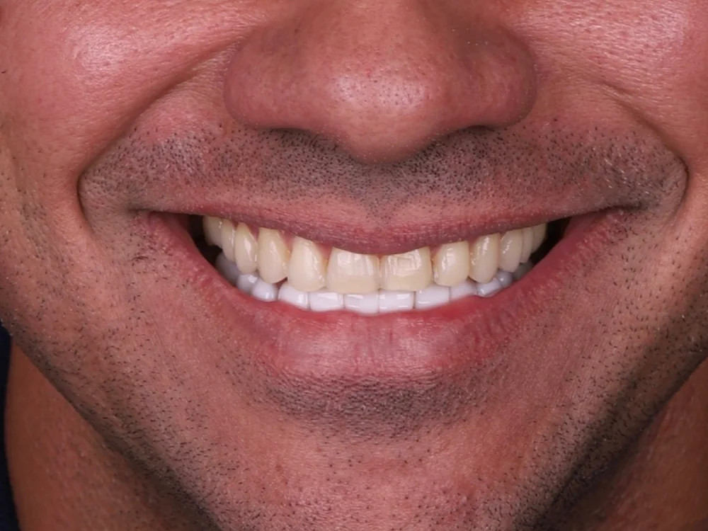 Estética do Sorriso antes do tratamento